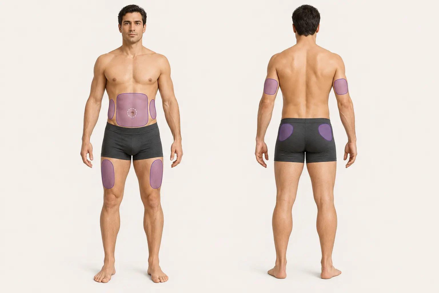 Front and back anatomical views with aligned subcutaneous injection zones on the abdomen, flanks, outer thighs, backs of the upper arms, and upper outer glutes